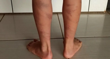 Criança é espancada pelo pai por assistir pornografia, diz polícia